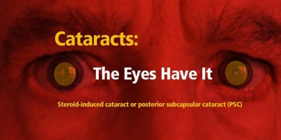 Cataracts-The-Eyes-Have-It